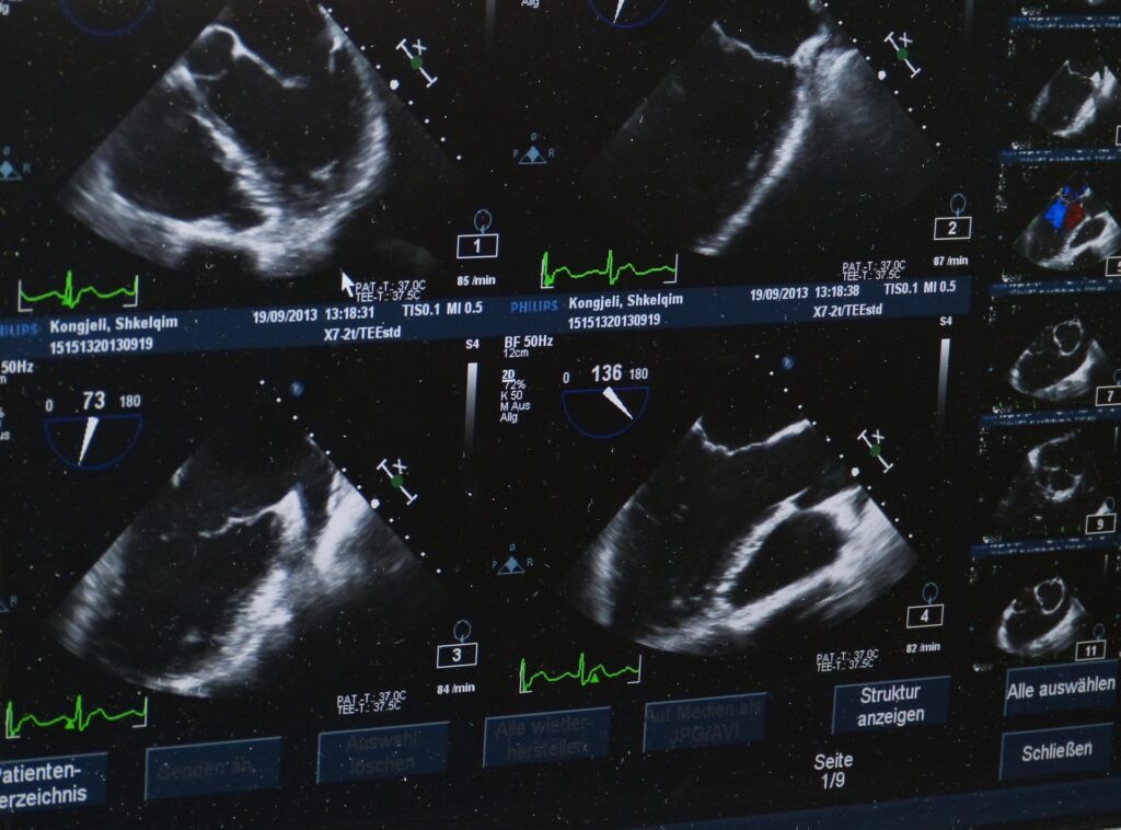 next-generation intraoperative ultrasound (IOUS) system